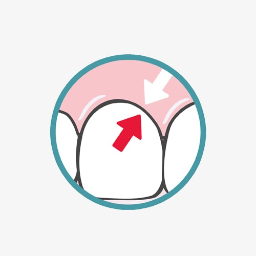 Colgate® Total® Pro Gum Health tandtråd